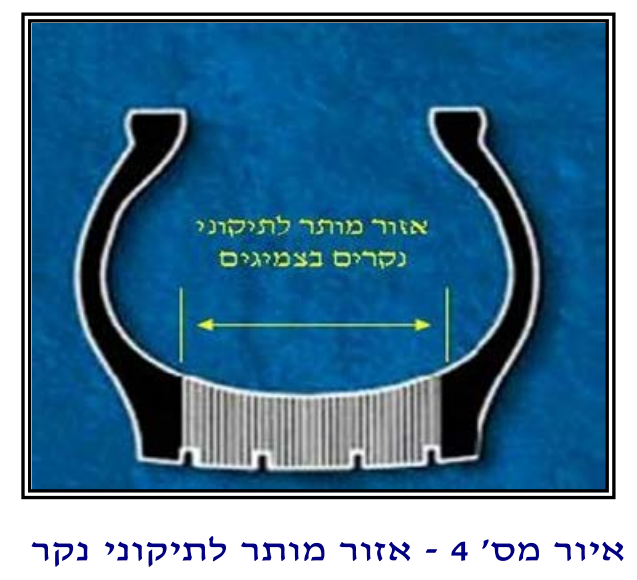 image.png.b3b6b487760b544460f3dfe5b6eb994c.png